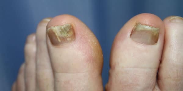 nails.jpg