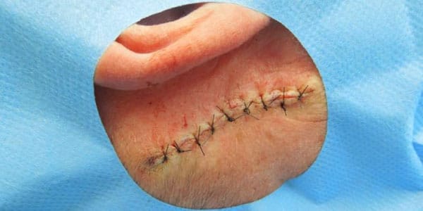 platic-surgery.jpg
